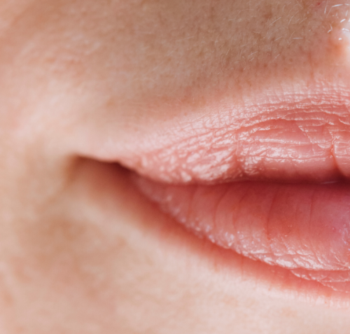 Bare Elegance Prp Micro-Needling