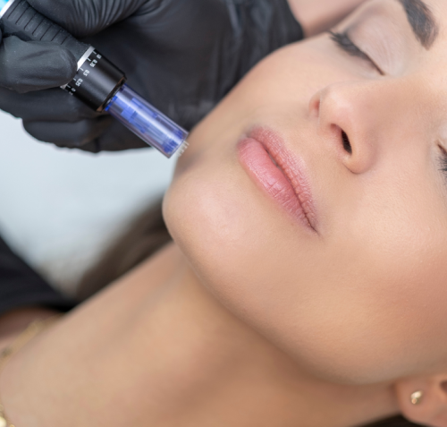 Best Rf Micro-Needling Treatment Near Me