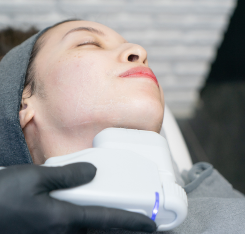 Hifu Anti-Aging Therapy For Wrinkles