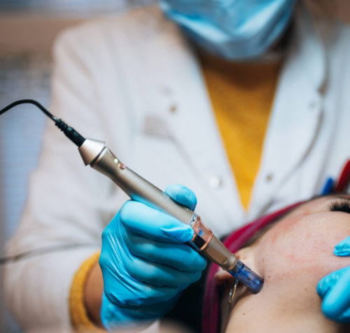 Prp Micro-Needling Treatment For Wrinkles Near Me