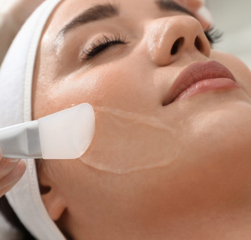 What Conditions Can Chemical Peels Treat