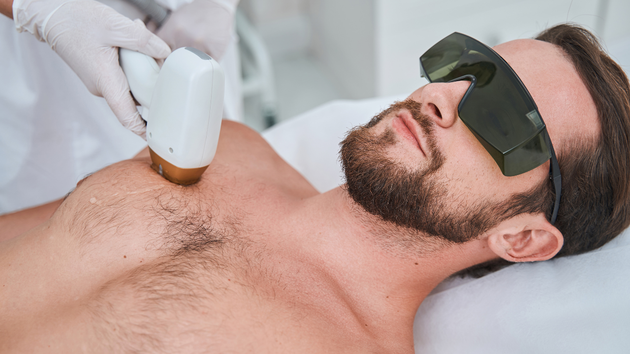 Laser_Hair_Removal_In_My_City_1